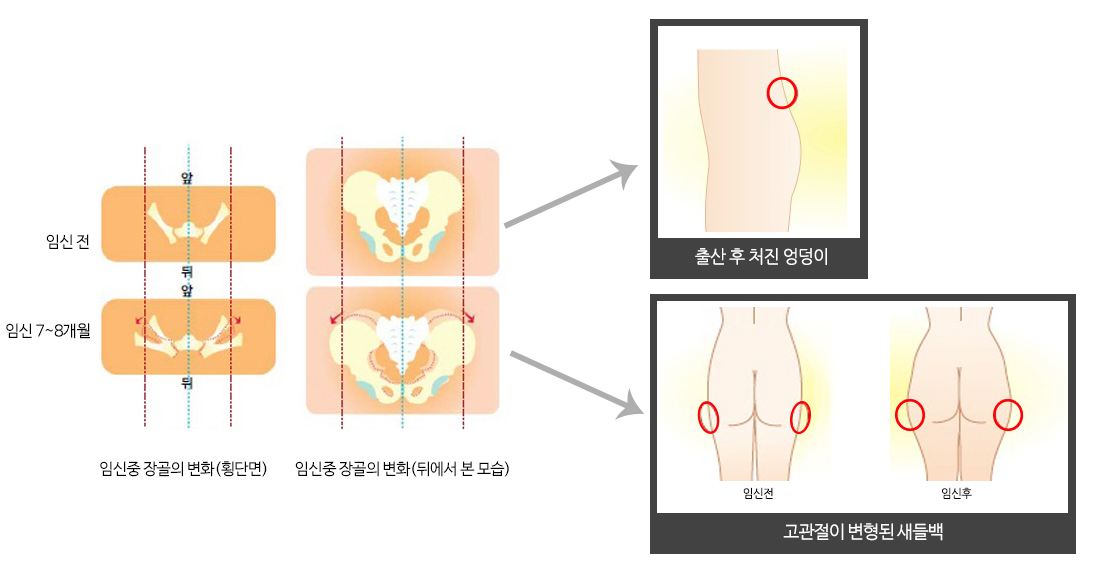 임신변화사진