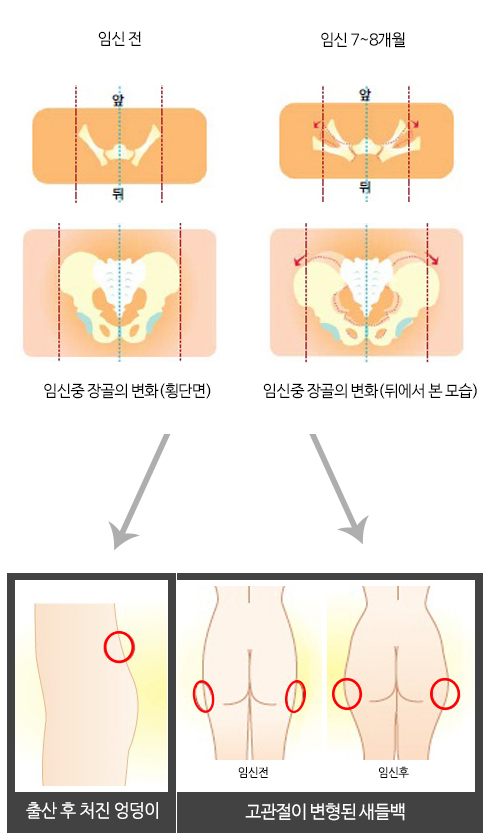 임신변화사진